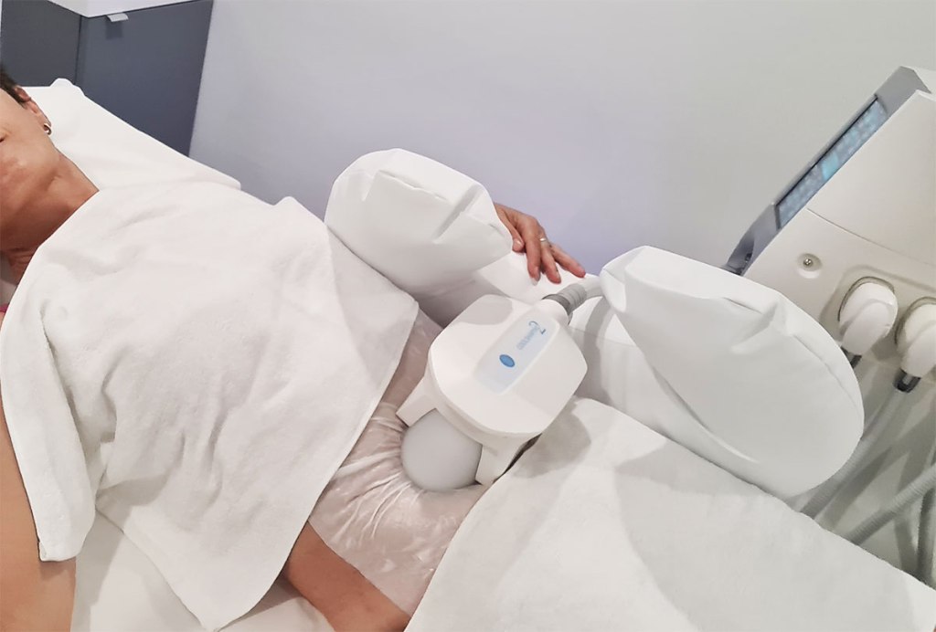 Cryolipolyse-par-aspiration-Depil-and-Young-Montpellier