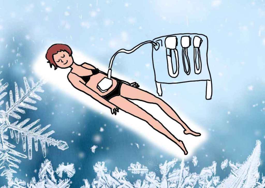 illu CRYOLIPOLYSE-LES-JOLIES-QUINQUAS